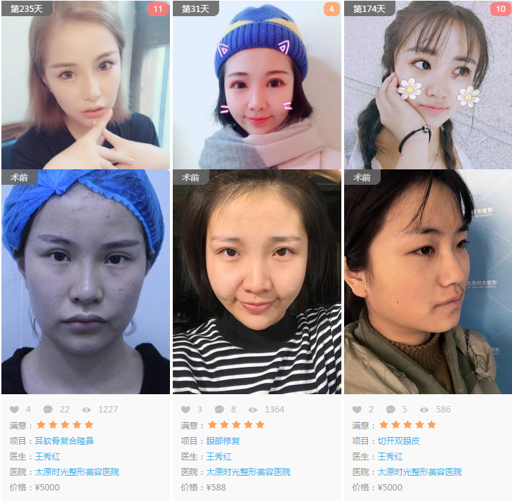 /ueditor/php/upload/image/20180822/1534926509579379.png