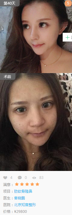 /ueditor/php/upload/image/20180824/1535092984129515.png