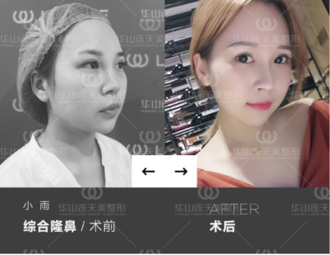 /ueditor/php/upload/image/20180831/1535695302397742.png