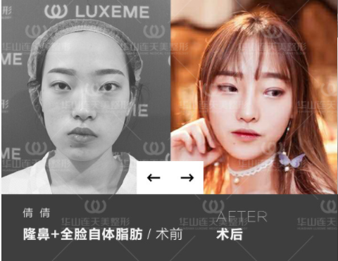 /ueditor/php/upload/image/20180831/1535695321435508.png