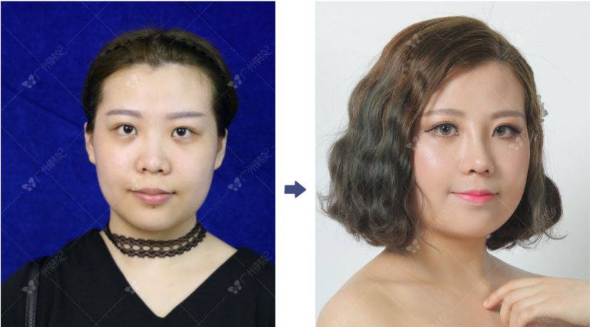 /ueditor/php/upload/image/20180904/1536049912588649.png
