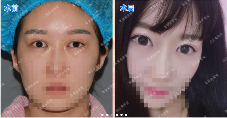 /ueditor/php/upload/image/20180914/1536908897223061.png