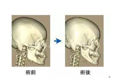 1583569825860721.png